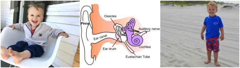 Our Experience with Ear Tubes